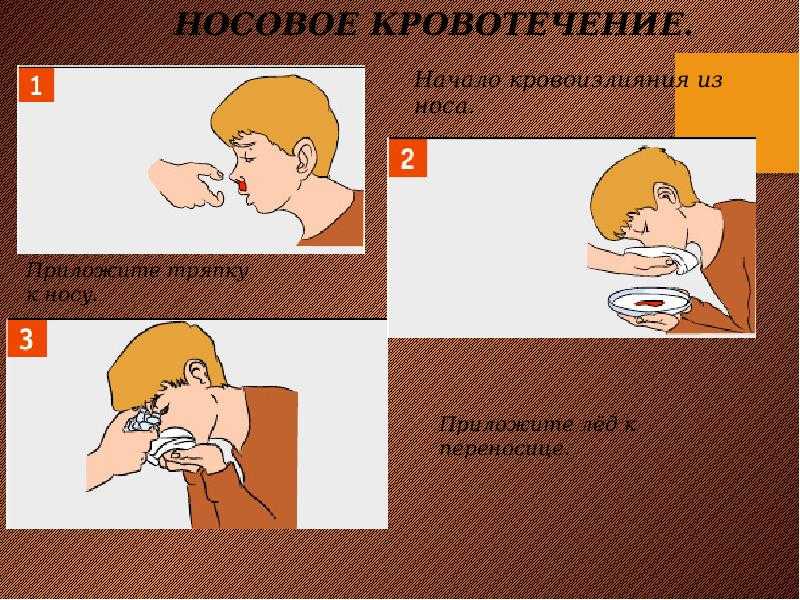 Острый панкреатит с госпитализацией: симптомы, диагностика, лечение