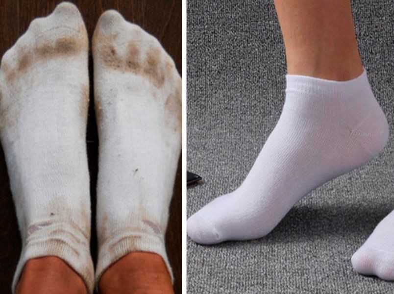Как отстирать белые носки в домашних условиях, как быстро отбелить носки от черной подошвы
