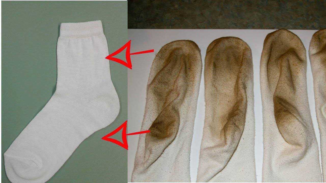 Как отстирать белые носки в домашних условиях из разной ткани